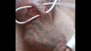 I put the headphone plug alongside my urethra with an increment of alongside my big load of shit piercing holes&period; with an increment of I cum like crazy twice&period;